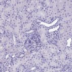 Immunohistochemical staining of human kidney shows no positivity in cells in tubules as expected.