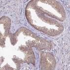 Immunohistochemical staining of human prostate shows moderate granular cytoplasmic positivity in glandular cells.