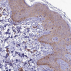 Immunohistochemical staining of human skin shows weak cytoplasmic positivity in squamous epithelial cells.