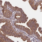 Immunohistochemical staining of human Fallopian tube shows strong cytoplasmic positivity in glandular cells.