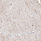 Immunohistochemical staining of human skeletal muscle shows moderate granular cytoplasmic positivity in myocytes.