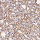 Immunohistochemical staining of human stomach shows strong granular cytoplasmic positivity in glandular cells.