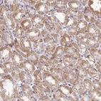 Immunohistochemical staining of human stomach shows strong granular cytoplasmic positivity in glandular cells.