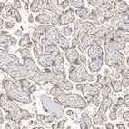 Immunohistochemical staining of human placenta shows moderate granular cytoplasmic positivity in trophoblastic cells.