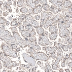Immunohistochemical staining of human placenta shows moderate granular cytoplasmic positivity in trophoblastic cells.