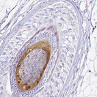 Anti-S100A3 Antibody