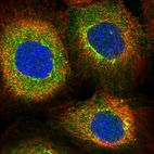 Immunofluorescent staining of human cell line A-431 shows localization to cytosol.