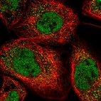 Immunofluorescent staining of human cell line A-431 shows positivity in cytoplasm & nucleus but excluded from the nucleoli.
