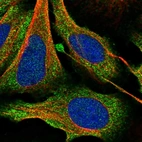 Immunofluorescent staining of human cell line U-2 OS shows localization to cytosol.