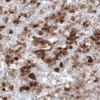 Anti-TSHB Antibody