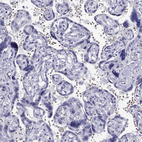 Immunohistochemical staining of human placenta shows no positivity in trophoblastic cells as expected.