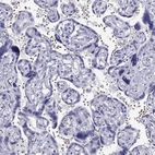 Immunohistochemical staining of human placenta shows no positivity in trophoblastic cells as expected.