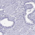 Immunohistochemical staining of human prostate shows no positivity in glandular cells as expected.