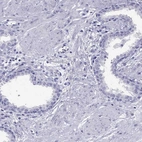 Immunohistochemical staining of human prostate shows no positivity in glandular cells as expected.