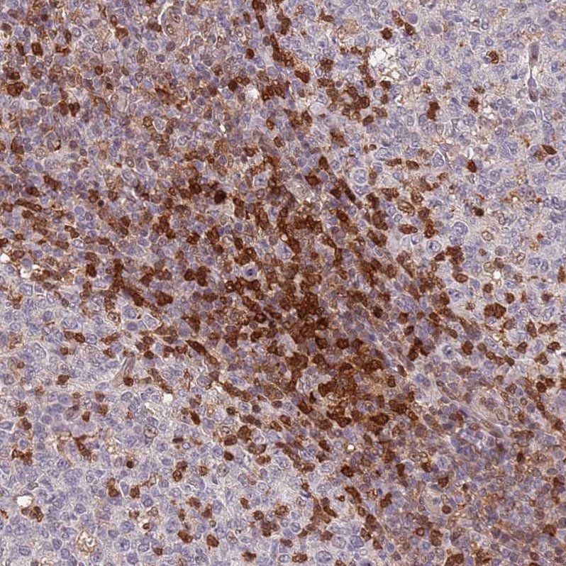 Anti-GBP2 Antibody