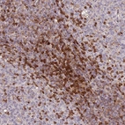 Anti-GBP2 Antibody