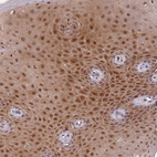 Immunohistochemical staining of human skin shows moderate nuclear and cytoplasmic positivity in squamous epithelial cells.