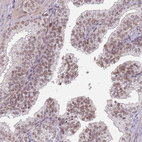 Immunohistochemical staining of human prostate shows weak nuclear positivity in glandular cells.