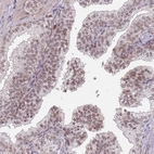 Immunohistochemical staining of human prostate shows weak nuclear positivity in glandular cells.