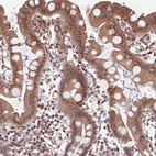 Immunohistochemical staining of human small intestine shows moderate cytoplasmic positivity in glandular cells.