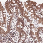 Immunohistochemical staining of human small intestine shows moderate cytoplasmic positivity in glandular cells.