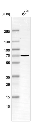 Western blot analysis in human cell line RT-4.