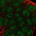 Immunofluorescent staining of human cell line RT4 shows localization to nucleoplasm & cytosol.