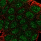 Immunofluorescent staining of human cell line RT4 shows localization to nucleoplasm & cytosol.