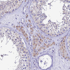 Immunohistochemical staining of human testis shows strong granular cytoplasmic positivity in Leydig cells.
