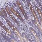 Immunohistochemical staining of human duodenum shows strong granular cytoplasmic positivity in glandular cells.