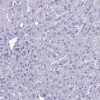 Immunohistochemical staining of human liver shows no positivity in hepatocytes.