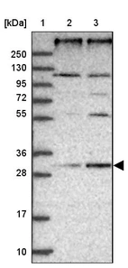 Lane 1: Marker [kDa] 250, 130, 95, 72, 55, 36, 28, 17, 10_br/_Lane 2: Human cell line RT-4_br/_Lane 3: Human cell line U-251MG sp