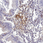 Anti-CLEC11A Antibody