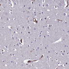 Immunohistochemical staining of human cerebral cortex shows strong cytoplasmic positivity in endothelial cells.