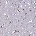 Immunohistochemical staining of human cerebral cortex shows strong cytoplasmic positivity in endothelial cells.