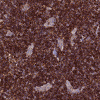 Immunohistochemical staining of human lymph node shows strong cytoplasmic positivity in lymphoid cells.