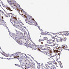 Immunohistochemical staining of human lung shows strong cytoplasmic positivity in macrophages.