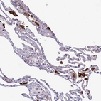 Immunohistochemical staining of human lung shows strong cytoplasmic positivity in macrophages.