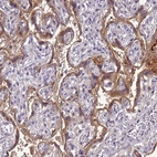 Immunohistochemical staining of human placenta shows moderate cytoplasmic/membranous positivity in trophoblastic cells.