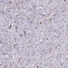 Immunohistochemical staining of human liver shows moderate cytoplasmic positivity in Kupffer cells.