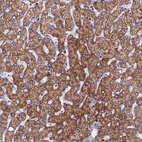 Immunohistochemical staining of human liver shows strong cytoplasmic-membranous positivity in hepatocytes.