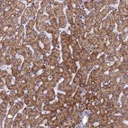 Immunohistochemical staining of human liver shows strong cytoplasmic-membranous positivity in hepatocytes.