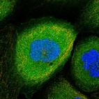 Immunofluorescent staining of human cell line A-431 shows localization to plasma membrane & cytosol.