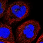Immunofluorescent staining of human cell line A-431 shows localization to centrosome.