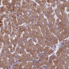 Anti-FADS1 Antibody