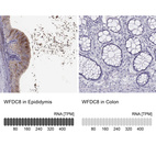 Anti-WFDC8 Antibody