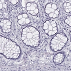 Immunohistochemical staining of human colon shows low expression as expected.