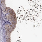 Immunohistochemical staining of human epididymis shows high expression.