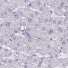Anti-WFDC8 Antibody
