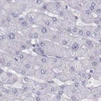 Immunohistochemical staining of human liver using Anti-WFDC8 antibody HPA042710.